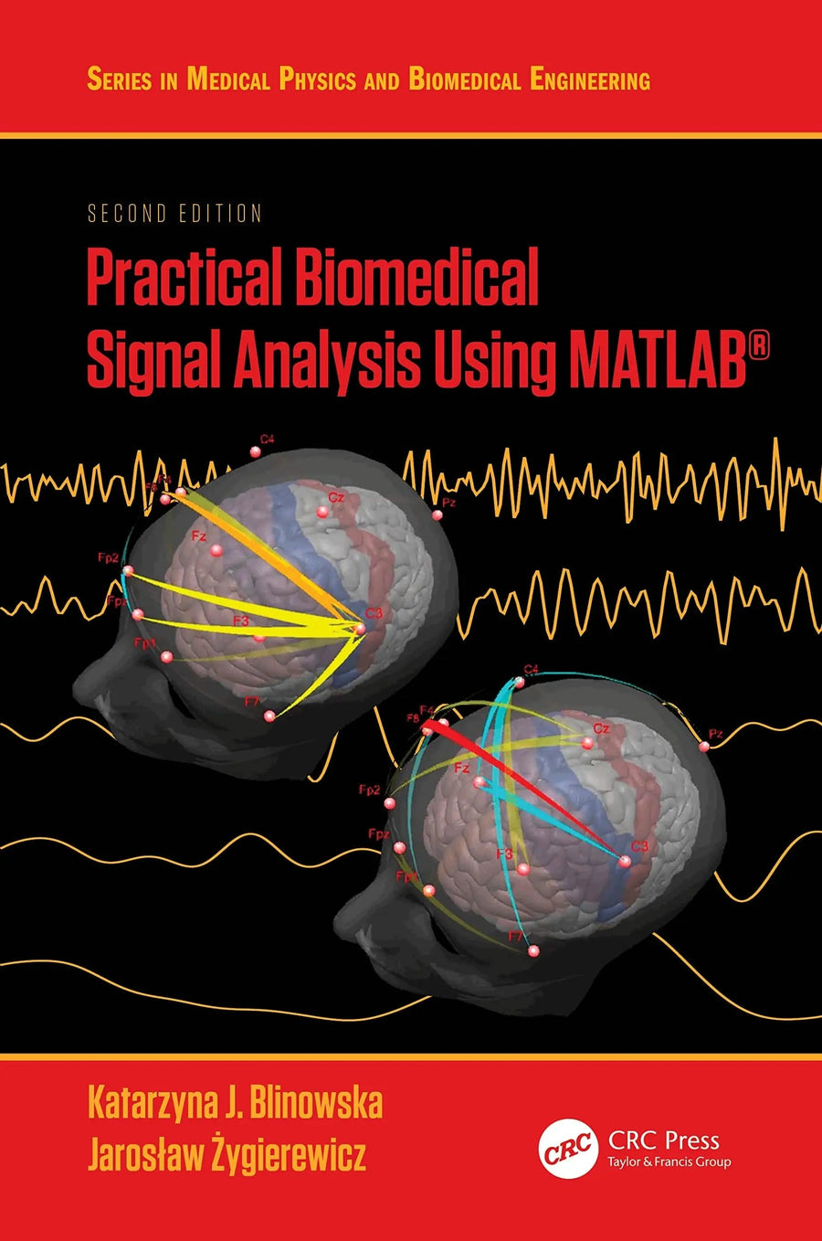 Practical Biomedical Signal Analysis Using MATLAB® by Katarzyna J. Blinowska