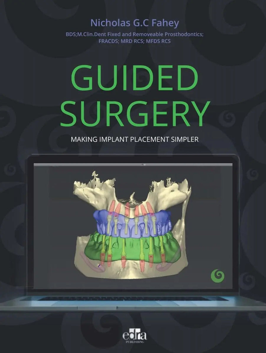 Guided Surgery. Making Implant Placement Simpler by Nicholas G.C. Fahey
