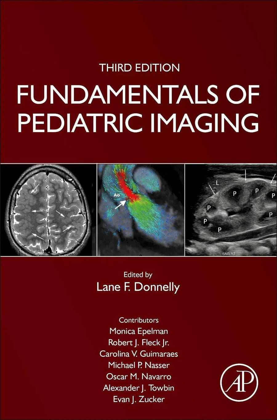 Fundamentals of Pediatric Imaging by Lane F. Donnelly