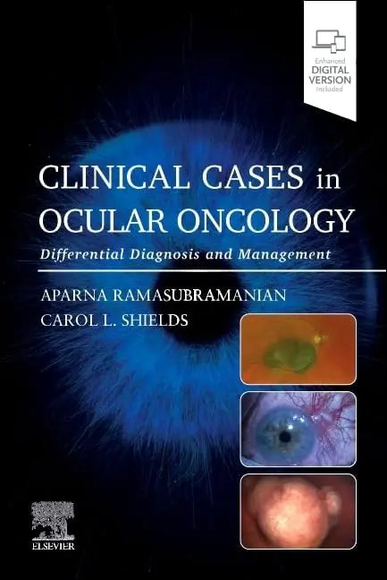 Clinical Cases in Ocular Oncology Differential Diagnosis and Management by Aparna Ramasubramanian