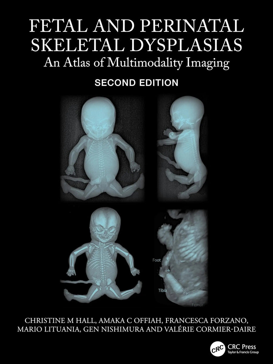 Fetal and Perinatal Skeletal Dysplasias An Atlas of Multimodality Imaging by Christine M. Hall