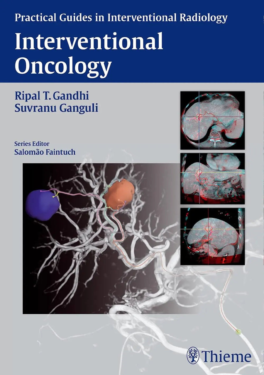 Interventional Oncology by Ripal T. Gandhi