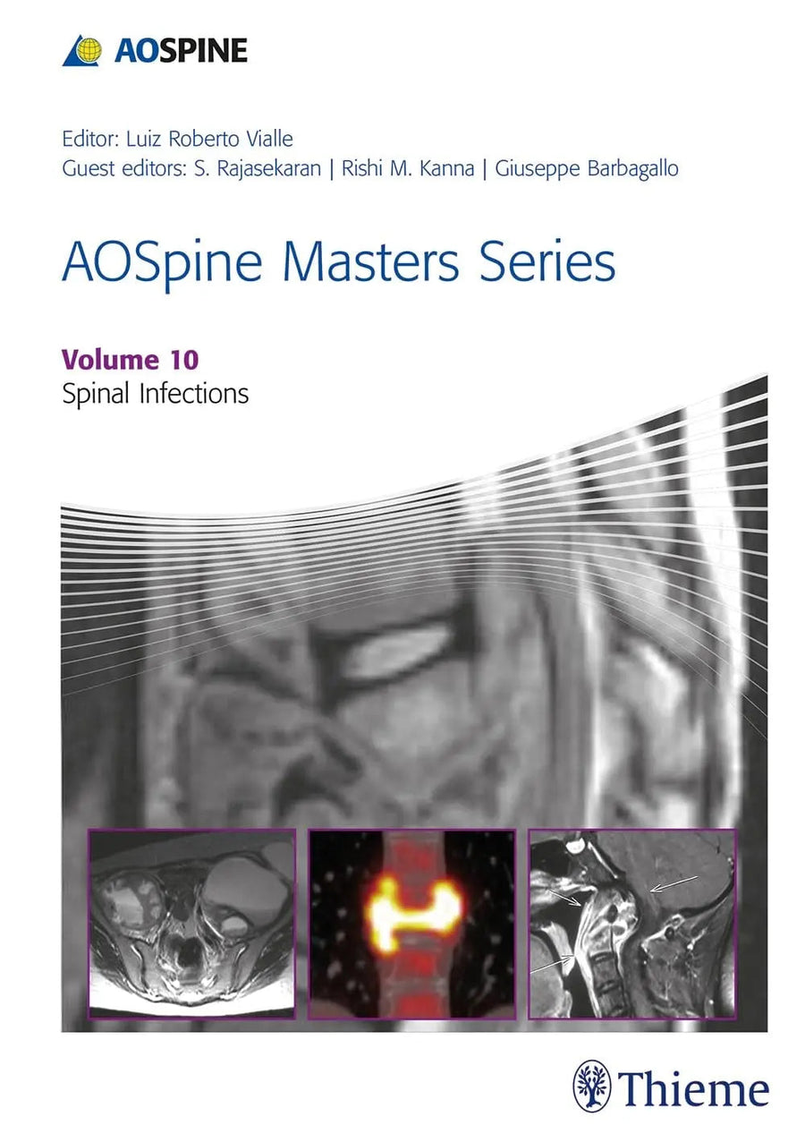 AOSpine Masters Series, Volume 10: Spinal Infections by Luiz Roberto Vialle