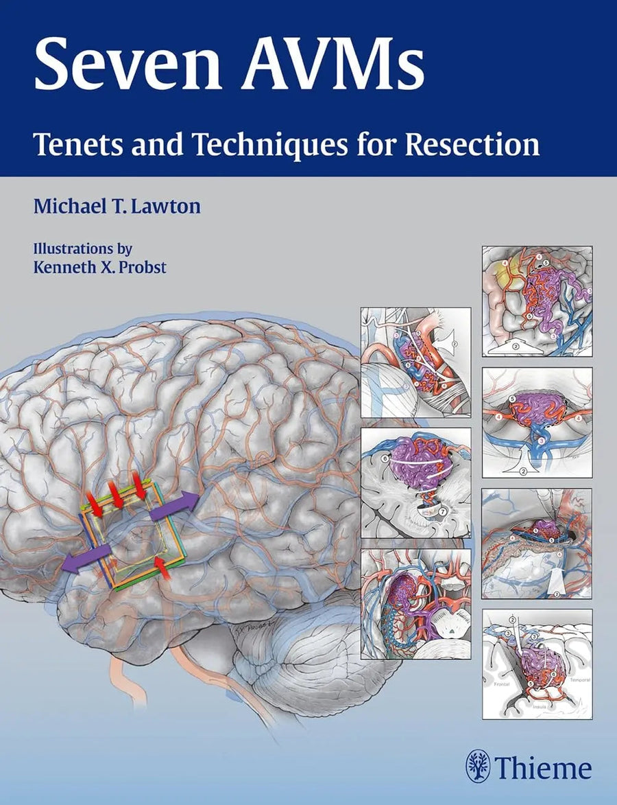 Seven AVMs Tenets and Techniques for Resection by Michael T. Lawton