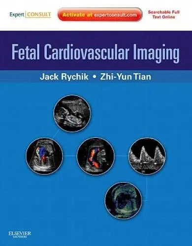 Fetal Cardiovascular Imaging A Disease-based Approach by Jack Rychik