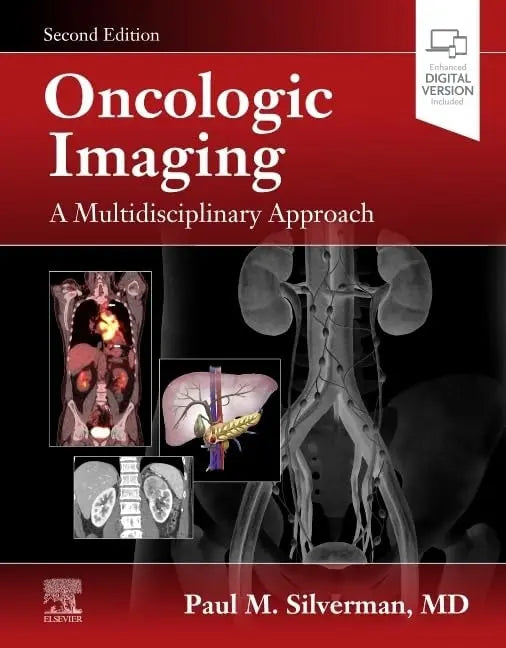 Oncologic Imaging A Multidisciplinary Approach by Paul M. Silverman
