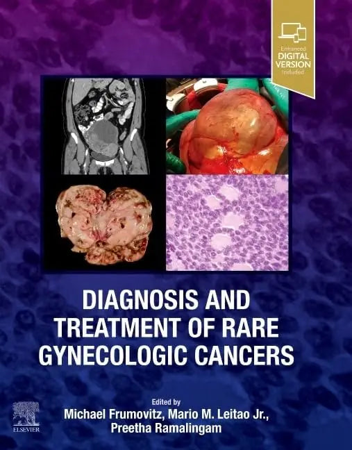 Diagnosis and Treatment of Rare Gynecologic Cancers by Mario M. Leitao Jr.