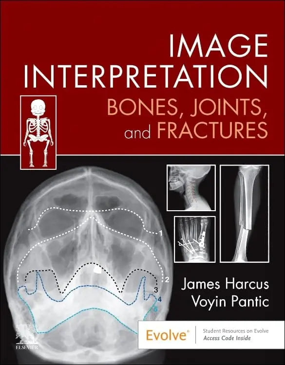 Image Interpretation: Bones, Joints, and Fractures by James Harcus