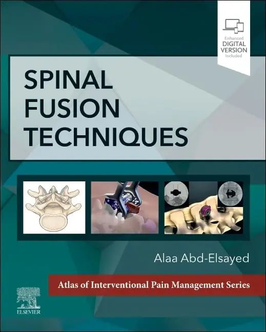 Spinal Fusion Techniques by Alaa Abd-Elsayed