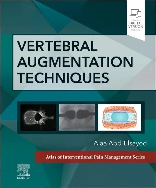 Vertebral Augmentation Techniques by Alaa Abd-Elsayed