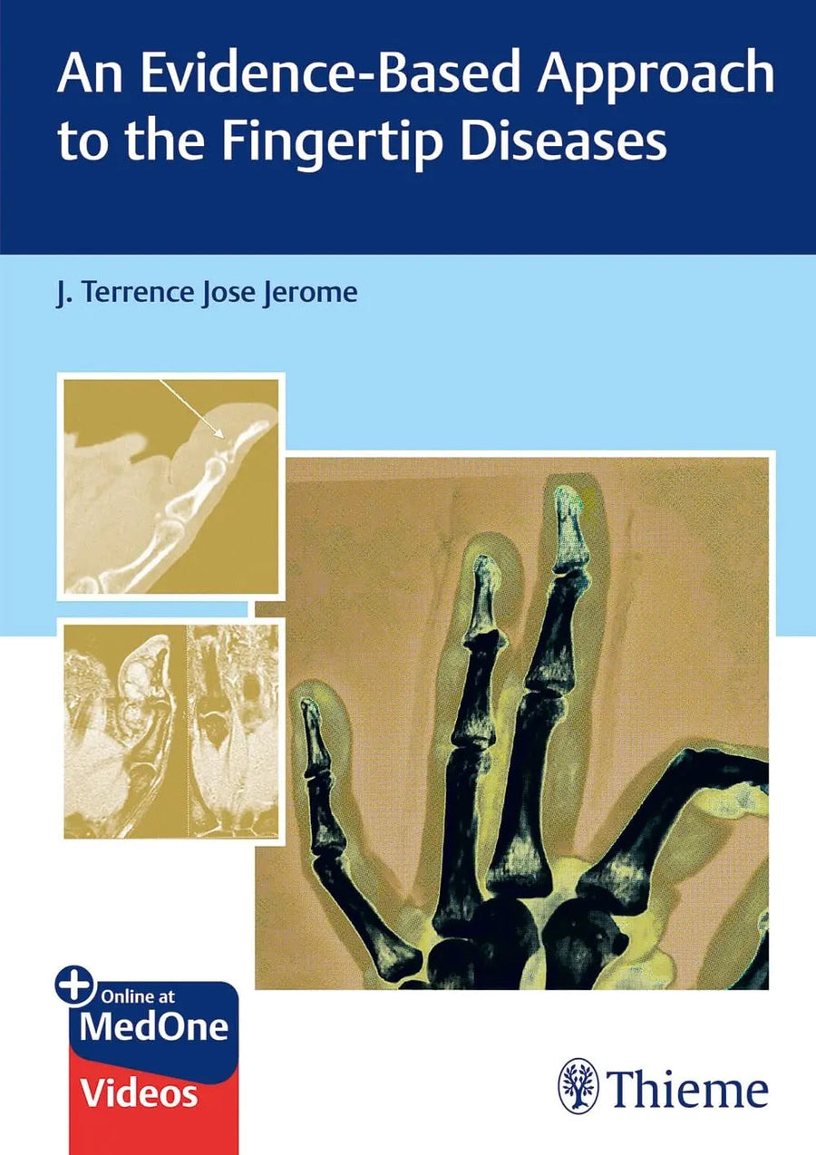 An Evidence-Based Approach to the Fingertip Diseases by J. Terrence Jerome